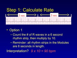Step 1: Calculate Rate
• Option 1
– Count the # of R waves in a 6 second
rhythm strip, then multiply by 10.
– Reminder: all rhythm strips in the Modules
are 6 seconds in length.
Interpretation? 9 x 10 = 90 bpm
3 sec 3 sec
 