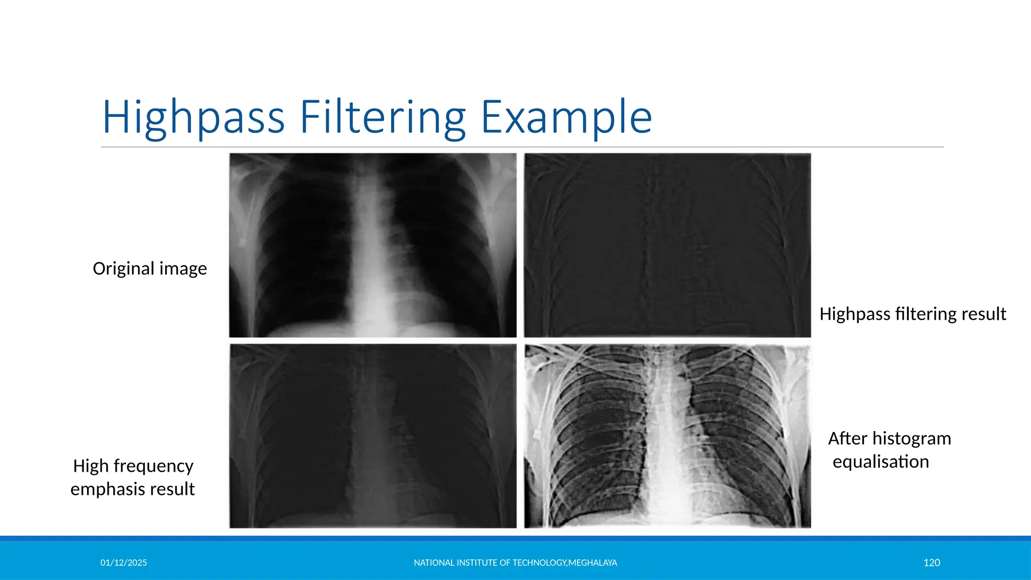 01/12/2025 NATIONAL INSTITUTE OF TECHNOLOGY,MEGHALAYA 120
Original image
Highpass filtering result
High frequency
emphasis result
Highpass Filtering Example
After histogram
equalisation
 