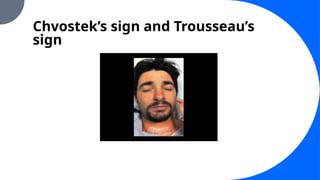 Chvostek’s sign and Trousseau’s
sign
 