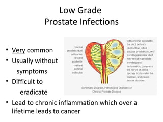 Low Grade
            Prostate Infections

• Very common
• Usually without
     symptoms
• Difficult to
      eradicate
• Lead to chronic inflammation which over a
  lifetime leads to cancer
 