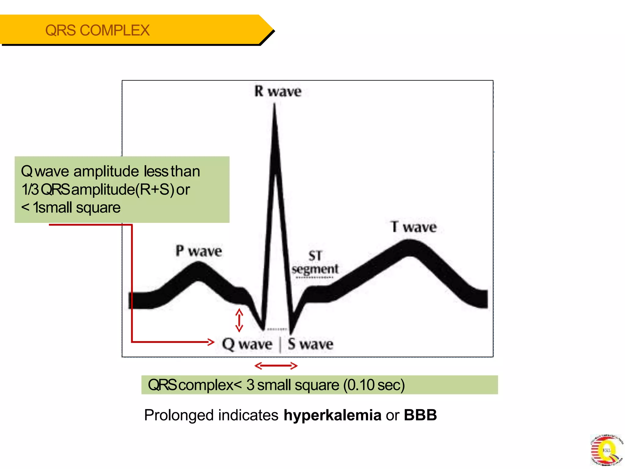Module 2 interpreting ecg rythm strips-1-converted | PPTX