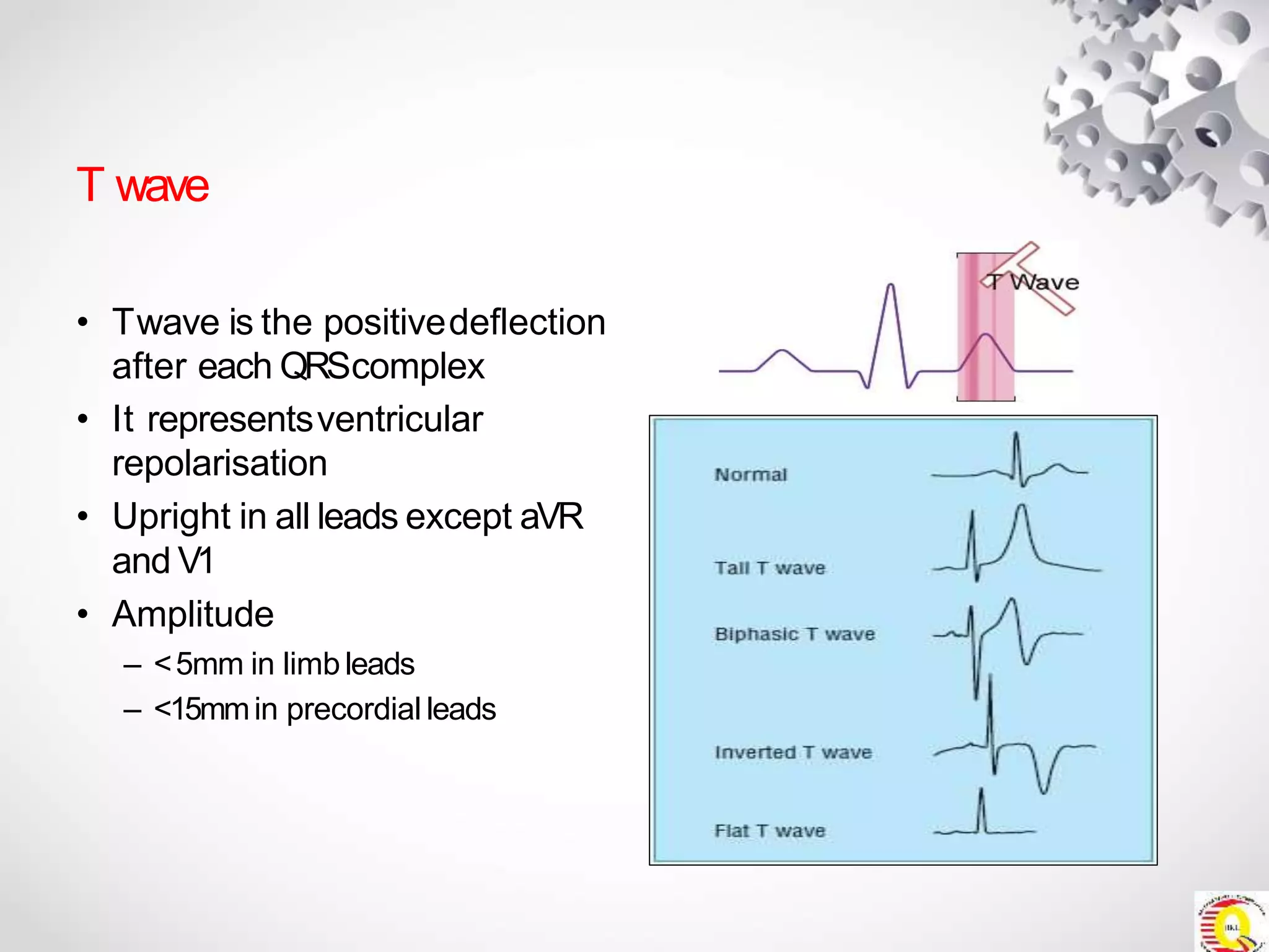 T wave
• Twave is the positivedeflection
after each QRScomplex
• It representsventricular
repolarisation
• Upright in all leads except aVR
and V1
• Amplitude
– <5mm in limb leads
– <15mmin precordial leads
 