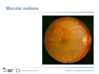 Module 205.2 en