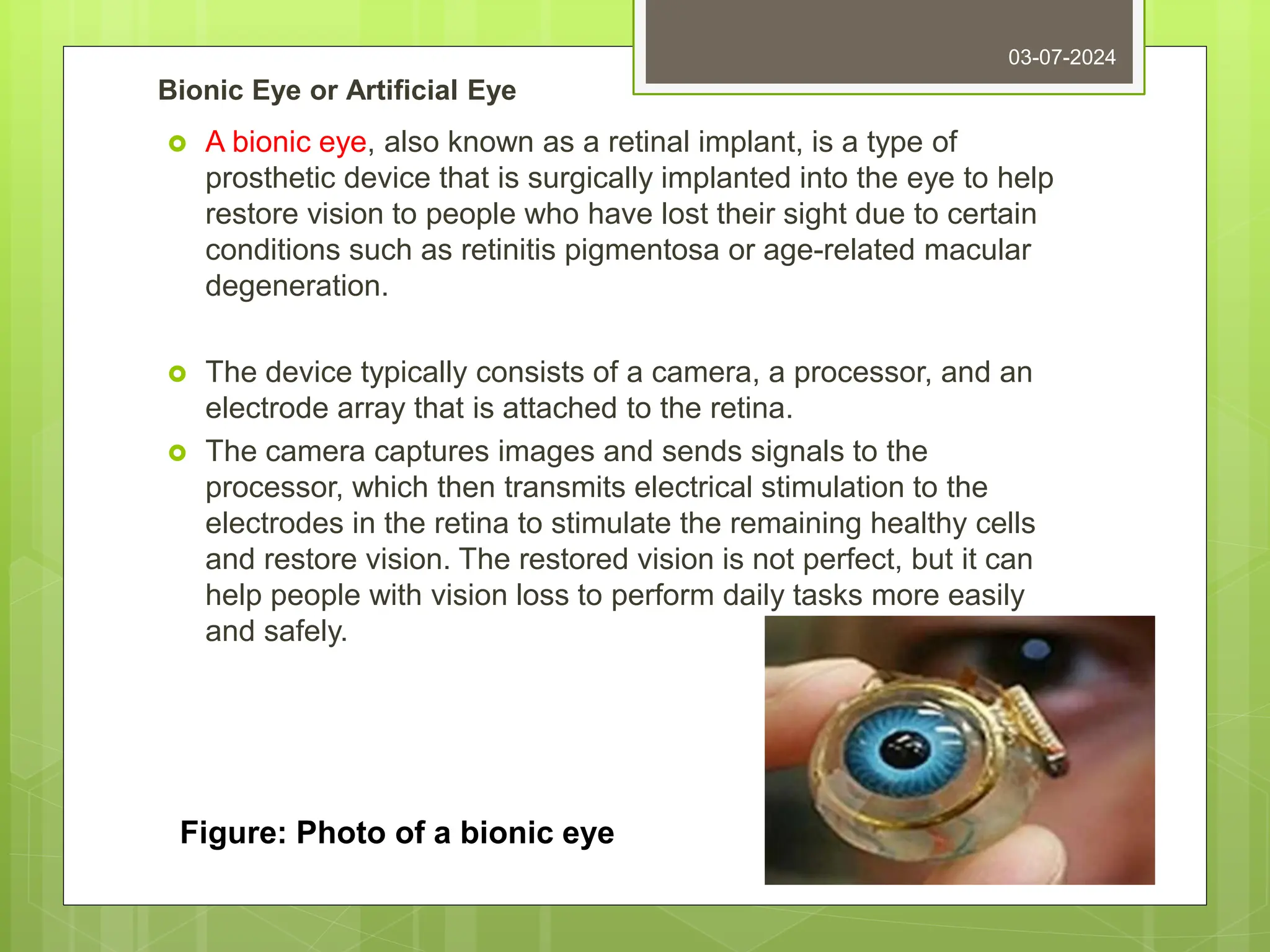 Bionic Eye or Artificial Eye
 A bionic eye, also known as a retinal implant, is a type of
prosthetic device that is surgically implanted into the eye to help
restore vision to people who have lost their sight due to certain
conditions such as retinitis pigmentosa or age-related macular
degeneration.
 The device typically consists of a camera, a processor, and an
electrode array that is attached to the retina.
 The camera captures images and sends signals to the
processor, which then transmits electrical stimulation to the
electrodes in the retina to stimulate the remaining healthy cells
and restore vision. The restored vision is not perfect, but it can
help people with vision loss to perform daily tasks more easily
and safely.
03-07-2024
Figure: Photo of a bionic eye
 