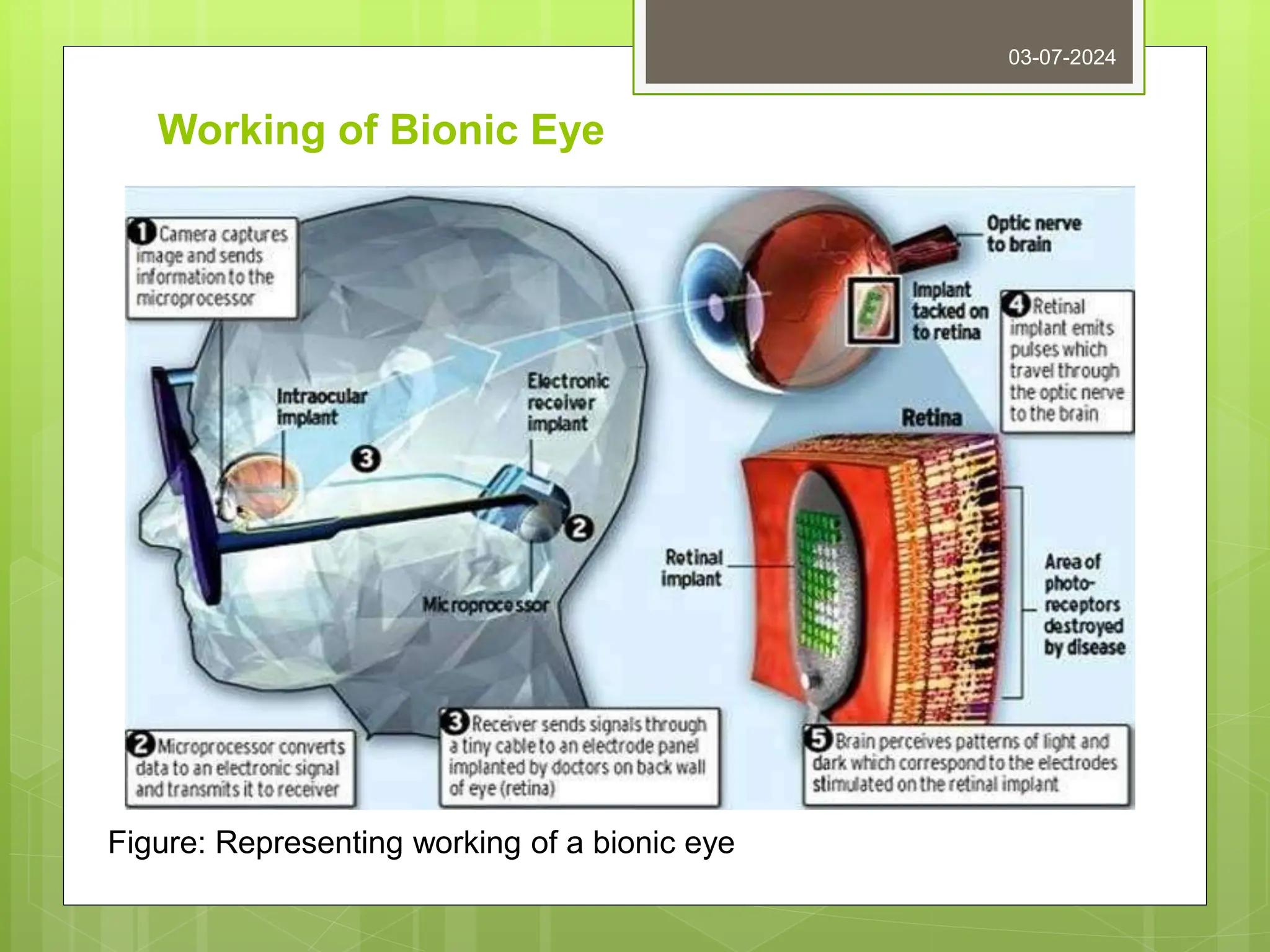 Working of Bionic Eye
03-07-2024
Figure: Representing working of a bionic eye
 