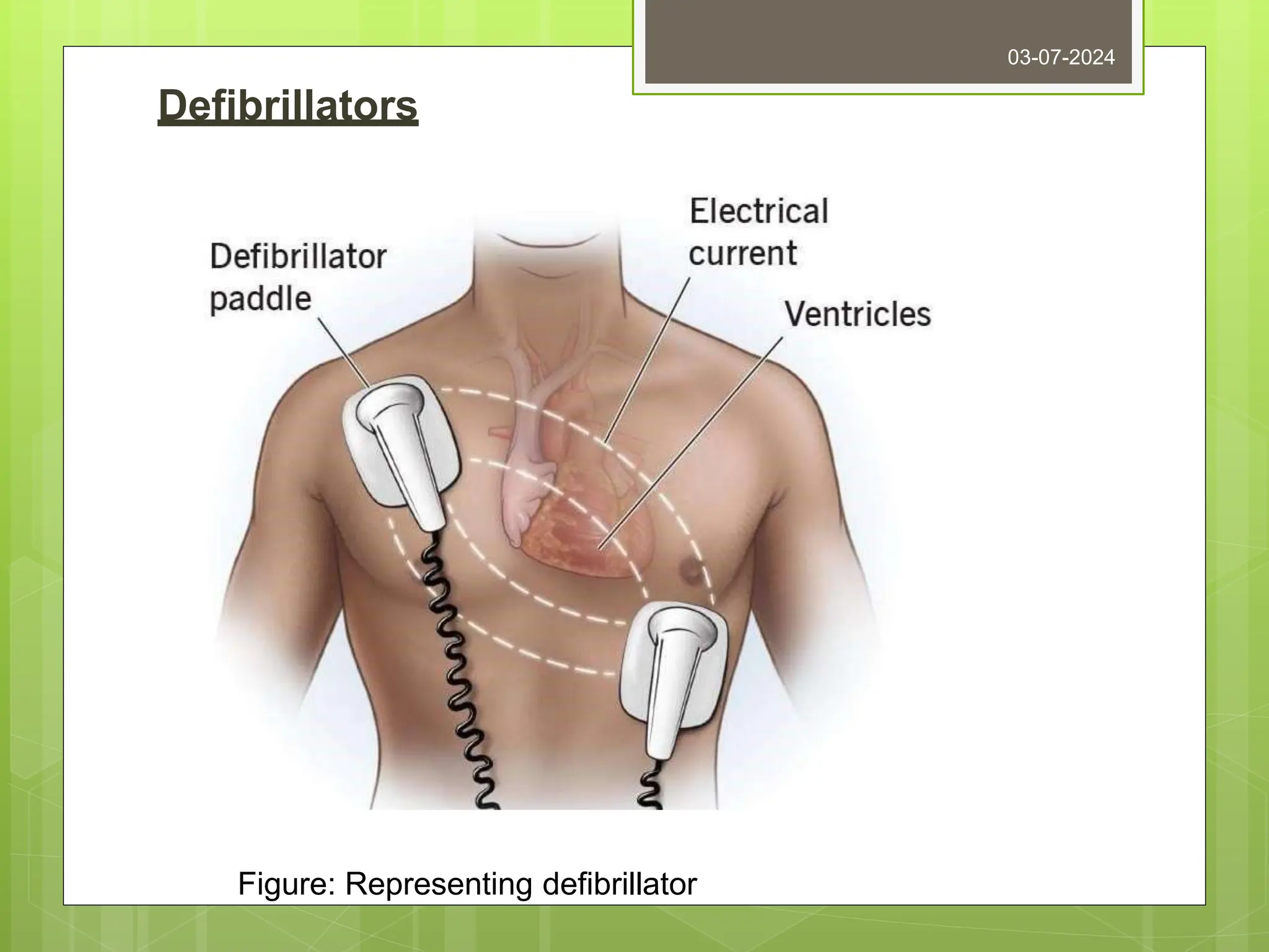 Defibrillators
03-07-2024
Figure: Representing defibrillator
 