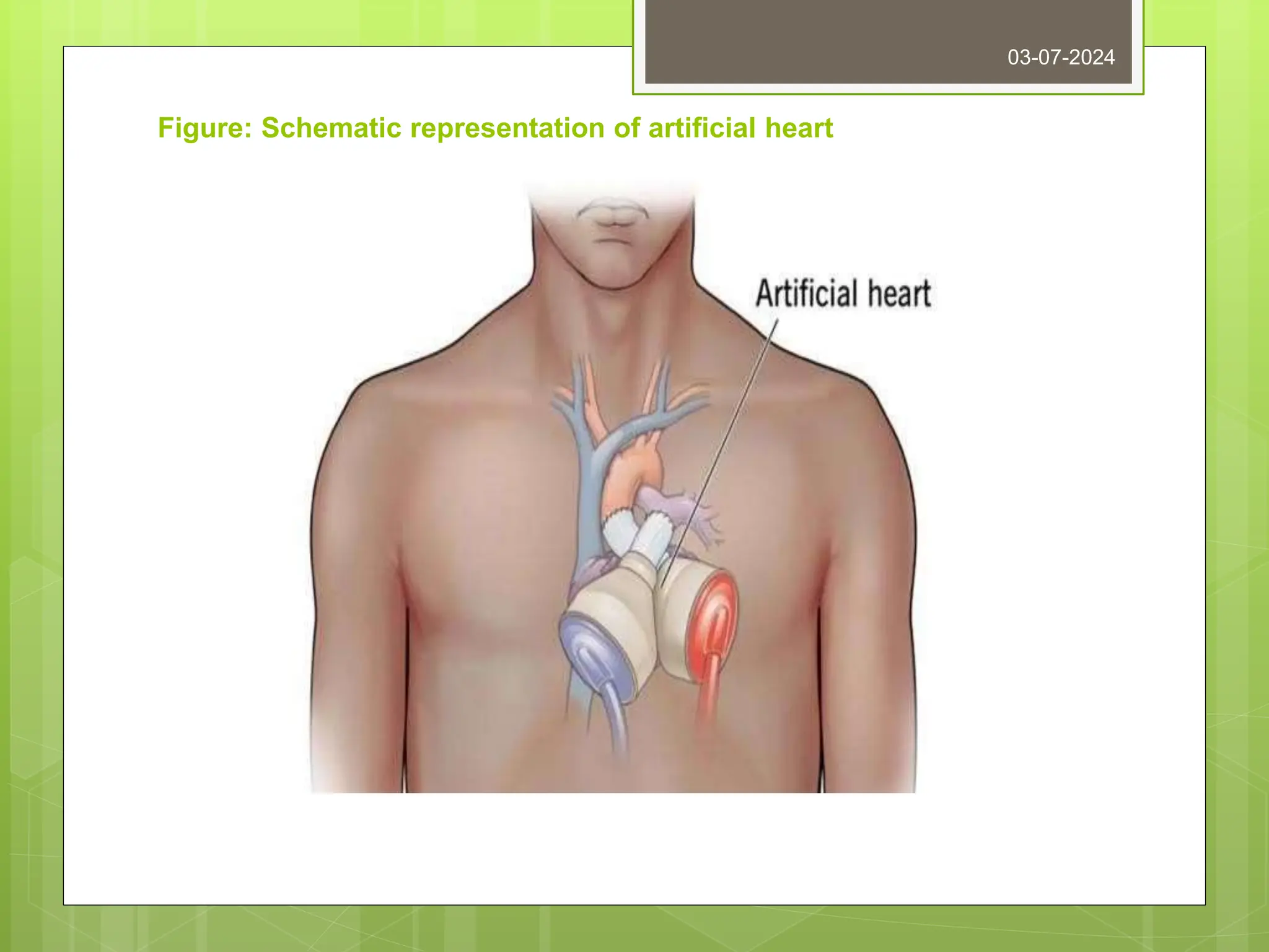 Figure: Schematic representation of artificial heart
03-07-2024
 