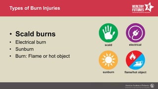 Module Burns Module 2 Burn Prevention.pptx
