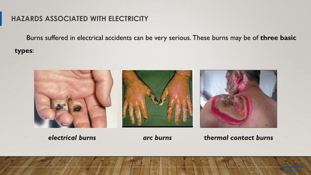 Module 2 Electrical Hazards Pdf Injuries Diseases And Conditions