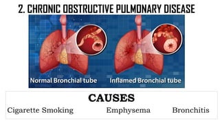 MODULE 2 Effects of Lifestyle in the Function of Respiratory and ...
