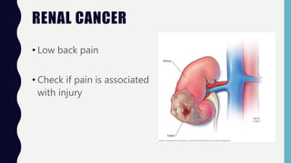 RENAL CANCER
• Low back pain
• Check if pain is associated
with injury
 