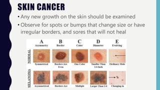 SKIN CANCER
• Any new growth on the skin should be examined
• Observe for spots or bumps that change size or have
irregular borders, and sores that will not heal
 