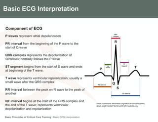 Components of the Gradian CCV SystemBasic ECG Interpretation
Component of ECG
Basic Principles of Critical Care Training I Basic ECG Interpretation
P waves represent atrial depolarization
PR interval from the beginning of the P wave to the
start of Q wave
QRS complex represents the depolarization of
ventricles; normally follows the P wave
ST segment begins from the start of S wave and ends
at beginning of the T wave.
T wave represents ventricular repolarization; usually a
small wave after the QRS complex
RR interval between the peak on R wave to the peak of
another
QT interval begins at the start of the QRS complex and
the end of the T wave; represents ventricular
depolarization and repolarization
https://commons.wikimedia.org/wiki/File:SinusRhythmL
abels.svg#/media/File:SinusRhythmLabels.svg
 