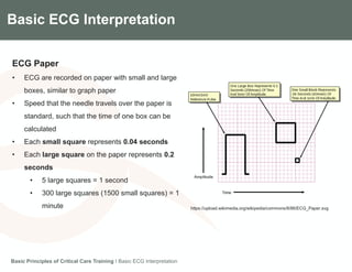 Components of the Gradian CCV SystemBasic ECG Interpretation
ECG Paper
• ECG are recorded on paper with small and large
boxes, similar to graph paper
• Speed that the needle travels over the paper is
standard, such that the time of one box can be
calculated
• Each small square represents 0.04 seconds
• Each large square on the paper represents 0.2
seconds
• 5 large squares = 1 second
• 300 large squares (1500 small squares) = 1
minute
Basic Principles of Critical Care Training I Basic ECG Interpretation
https://upload.wikimedia.org/wikipedia/commons/8/86/ECG_Paper.svg
 