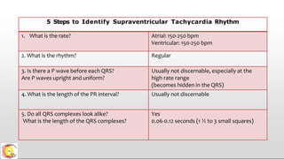 5 Steps to Identify Supraventricular Tachycardia Rhythm
1. What is the rate? Atrial: 150-250 bpm
Ventricular: 150-250 bpm
2. What is the rhythm? Regular
3. Is there a P wave before each QRS?
Are P waves upright and uniform?
Usually not discernable, especially at the
high rate range
(becomes hidden in the QRS)
4. What is the length of the PR interval? Usually not discernable
5. Do all QRS complexes look alike?
What is the length of the QRS complexes?
Yes
0.06-0.12 seconds (1 ½ to 3 small squares)
 