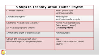 5 Steps to Identify Atrial Flutter Rhythm
1. What is the rate? Atrial: 250-400 bpm
Ventricular: variable
2. What is the rhythm? Atrial: regular
Ventricular: may be irregular
3. Is there a P wave before each QRS?
Are P waves upright and uniform?
Normal P waves are absent;
flutter waves (f waves)
(sawtooth pattern)
4. What is the length of the PR interval? Not measurable
5. Do all QRS complexes look alike?
What is the length of the QRS complexes?
Yes
0.06-0.12 seconds (1 ½ to 3 small
squares)
 