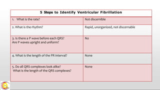 5 Steps to Identify Ventricular Fibrillation
1. What is the rate? Not discernible
2. What is the rhythm? Rapid, unorganized, not discernable
3. Is there a P wave before each QRS?
Are P waves upright and uniform?
No
4. What is the length of the PR interval? None
5. Do all QRS complexes look alike?
What is the length of the QRS complexes?
None
 