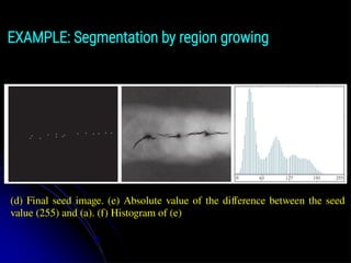 EXAMPLE: Segmentation by region growing
(d) Final seed image. (e) Absolute value of the difference between the seed
value (255) and (a). (f) Histogram of (e)
 