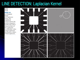 LINE DETECTION: Laplacian Kernel
 