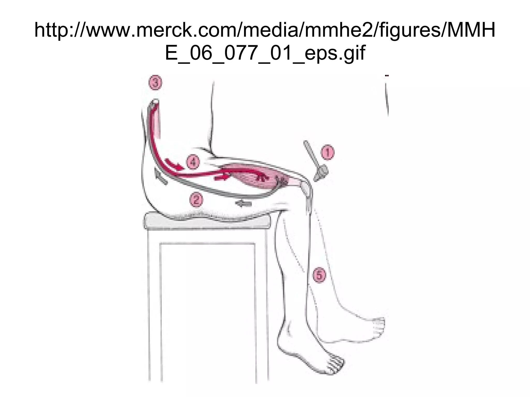 http://www.merck.com/media/mmhe2/figures/MMHE_06_077_01_eps.gif 
