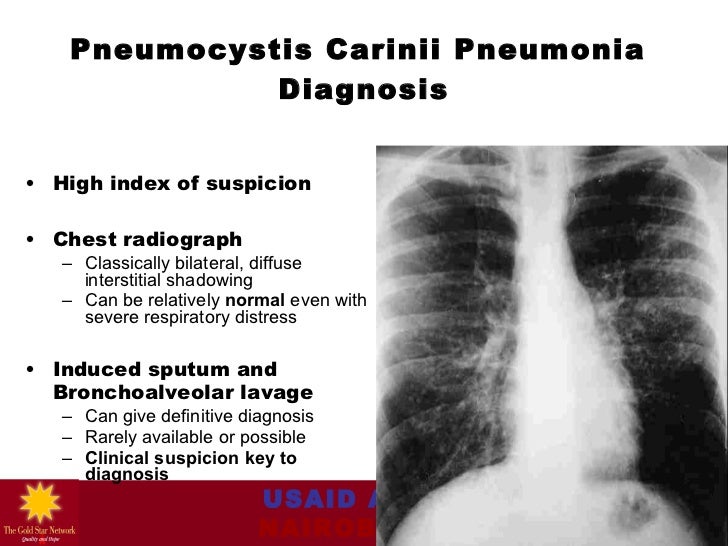 Module 3 opportunistic infections and hiv related conditi