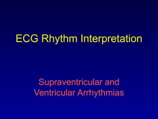 ECG Rhythm Interpretation
Supraventricular and
Ventricular Arrhythmias
 