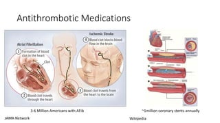 Antithrombotic Medications
JAMA Network Wikipedia
3-6 Million Americans with AFib ~1million coronary stents annually
 