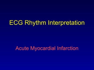 ECG Rhythm Interpretation
Acute Myocardial Infarction
 