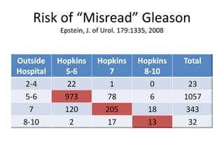 Risk of “Misread” Gleason
    Epstein, J. of Urol. 179:1335, 2008
 