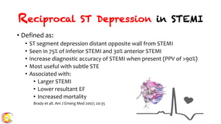 Module 5 tips and tricks- stemi ecg recognition & patterns finale | PDF