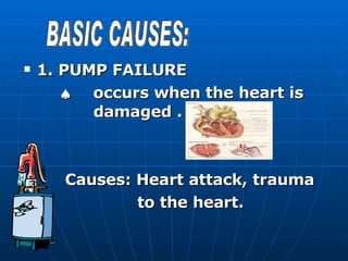 1. PUMP FAILURE    occurs when the heart is  damaged . Causes: Heart attack, trauma  to the heart. BASIC CAUSES: 