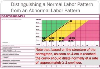 Partograph.pdf