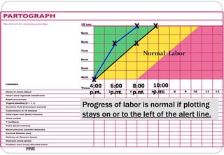 Partograph.pdf