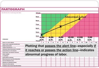 Partograph Contraction Line Partograph.pdf