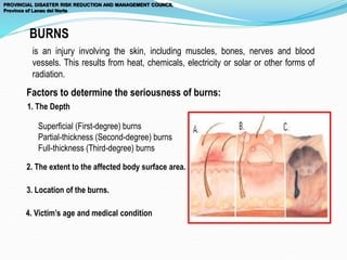 Factors to determine the seriousness of burns:
1. The Depth
Superficial (First-degree) burns
Partial-thickness (Second-degree) burns
Full-thickness (Third-degree) burns
is an injury involving the skin, including muscles, bones, nerves and blood
vessels. This results from heat, chemicals, electricity or solar or other forms of
radiation.
2. The extent to the affected body surface area.
3. Location of the burns.
4. Victim’s age and medical condition
BURNS
PROVINCIAL DISASTER RISK REDUCTION AND MANAGEMENT COUNCIL
Province of Lanao del Norte
 