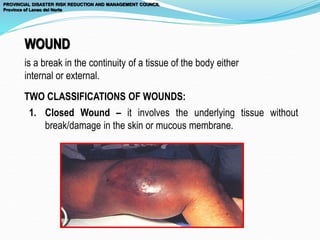 TWO CLASSIFICATIONS OF WOUNDS:
is a break in the continuity of a tissue of the body either
internal or external.
1. Closed Wound – it involves the underlying tissue without
break/damage in the skin or mucous membrane.
WOUND
PROVINCIAL DISASTER RISK REDUCTION AND MANAGEMENT COUNCIL
Province of Lanao del Norte
 