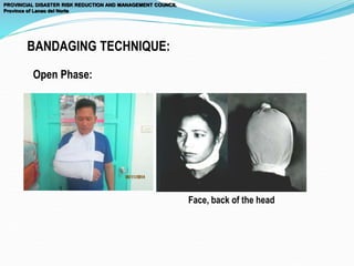 PROVINCIAL DISASTER RISK REDUCTION AND MANAGEMENT COUNCIL
Province of Lanao del Norte
BANDAGING TECHNIQUE:
Open Phase:
Face, back of the head
 