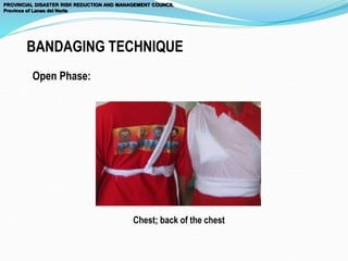 BANDAGING TECHNIQUE
Open Phase:
PROVINCIAL DISASTER RISK REDUCTION AND MANAGEMENT COUNCIL
Province of Lanao del Norte
Chest; back of the chest
 