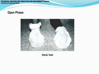 PROVINCIAL DISASTER RISK REDUCTION AND MANAGEMENT COUNCIL
Province of Lanao del Norte
Open Phase:
Hand, foot
 