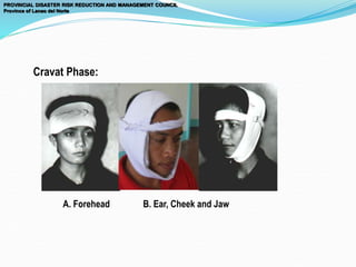 Cravat Phase:
PROVINCIAL DISASTER RISK REDUCTION AND MANAGEMENT COUNCIL
Province of Lanao del Norte
A. Forehead B. Ear, Cheek and Jaw
 
