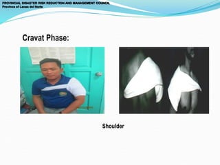 PROVINCIAL DISASTER RISK REDUCTION AND MANAGEMENT COUNCIL
Province of Lanao del Norte
Cravat Phase:
Shoulder
 