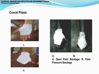 PROVINCIAL DISASTER RISK REDUCTION AND MANAGEMENT COUNCIL
Province of Lanao del Norte
Cravat Phase:
A. B.
A. Open Palm Bandage; B. Palm
Pressure Bandage
A.
B.
 