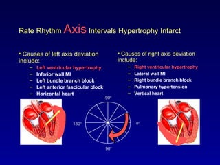 Rate Rhythm Axis Intervals Hypertrophy Infarct
• Causes of left axis deviation
include:
– Left ventricular hypertrophy
– Inferior wall MI
– Left bundle branch block
– Left anterior fascicular block
– Horizontal heart
0o
-90o
90o
180o
• Causes of right axis deviation
include:
– Right ventricular hypertrophy
– Lateral wall MI
– Right bundle branch block
– Pulmonary hypertension
– Vertical heart
 