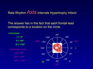 Rate Rhythm Axis Intervals Hypertrophy Infarct
The answer lies in the fact that each frontal lead
corresponds to a location on the circle.
0o
30o
-30o
60o
-60o
-90o
-120o
90o120o
150o
180o
-150o
I
II
avF
avLavR
Limb leads
I = +0o
II = +60o
III = +120o
Augmented leads
avL = -30o
avF = +90o
avR = -150o
I
IIIII
 