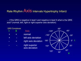 0o
30o
-30o
60o
-60o
-90o
-120o
90o120o
150o
180o
-150o
Rate Rhythm Axis Intervals Hypertrophy Infarct
… if the QRS is negative in lead I and negative in lead II what is the QRS
axis? (normal, left, right or right superior axis deviation)
QRS Complexes
I
AxisI II
+ +
+ -
- +
- -
normal
left axis deviation
right axis deviation
right superior
axis deviation
0o
30o
-30o
60o
-60o
-90o
-120o
90o120o
150o
180o
-150o
II
 