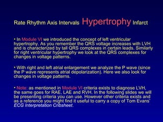 Rate Rhythm Axis Intervals Hypertrophy Infarct
• In Module VI we introduced the concept of left ventricular
hypertrophy. As you remember the QRS voltage increases with LVH
and is characterized by tall QRS complexes in certain leads. Similarly
for right ventricular hypertrophy we look at the QRS complexes for
changes in voltage patterns.
• With right and left atrial enlargement we analyze the P wave (since
the P wave represents atrial depolarization). Here we also look for
changes in voltage patterns.
• Note: as mentioned in Module VI criteria exists to diagnose LVH,
the same goes for RAE, LAE and RVH. In the following slides we will
be presenting criteria you can use. However other criteria exists and
as a reference you might find it useful to carry a copy of Tom Evans’
ECG Interpretation Cribsheet.
 