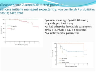 •50 men, mean age 69 with Gleason 7
•44 with 3+4, 6 with 4+3
•21 had otherwise favourable parameters
(PSA < 10, PSAD < 0.2, < 3 pos cores)
•29 unfavourable parameters
 