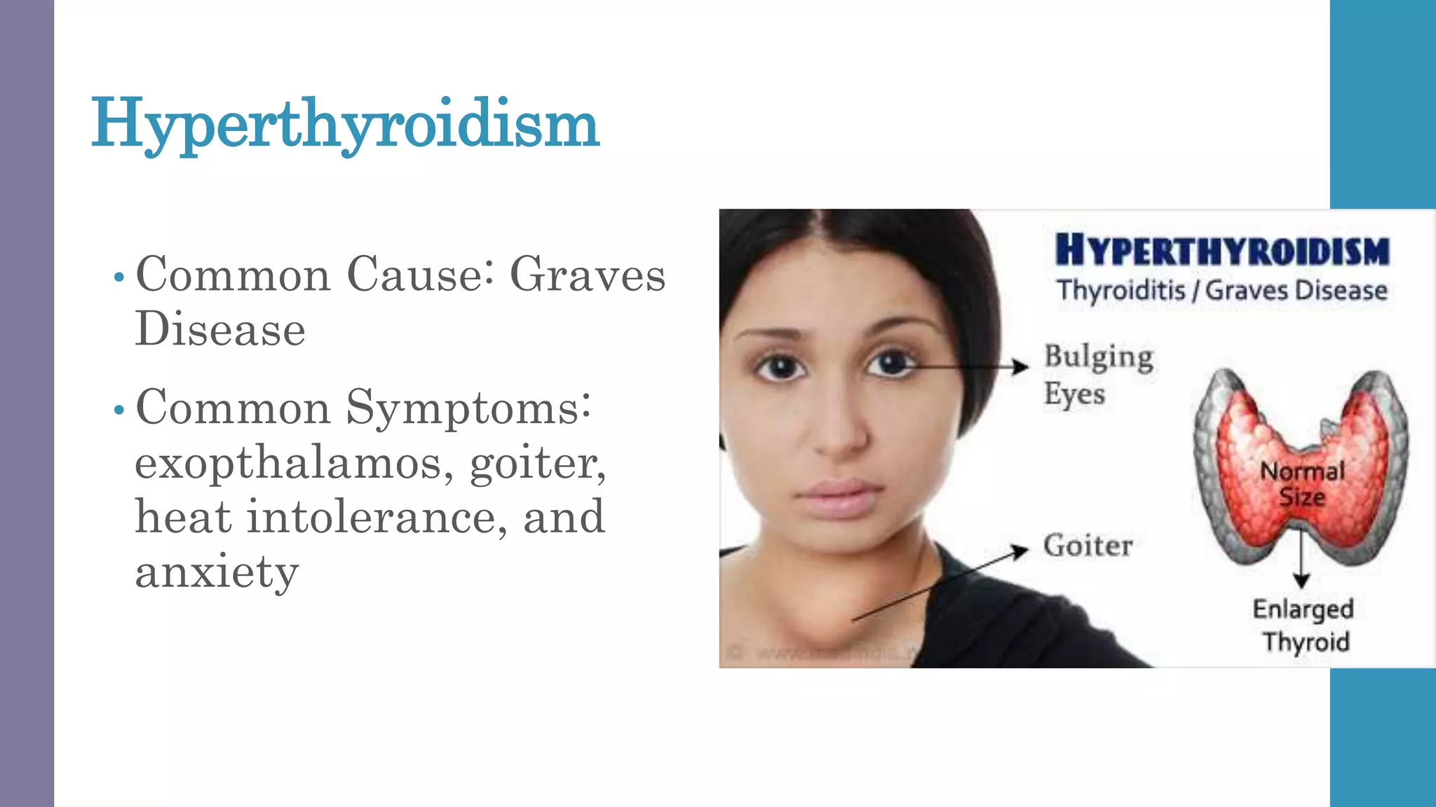 Hyperthyroidism
• Common Cause: Graves
Disease
• Common Symptoms:
exopthalamos, goiter,
heat intolerance, and
anxiety
 