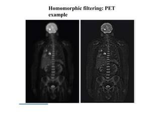 Homomorphic filtering: PET
example
 