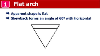 Flat arch1
Apparent shape is flat
Skewback forms an angle of 60o with horizontal
 